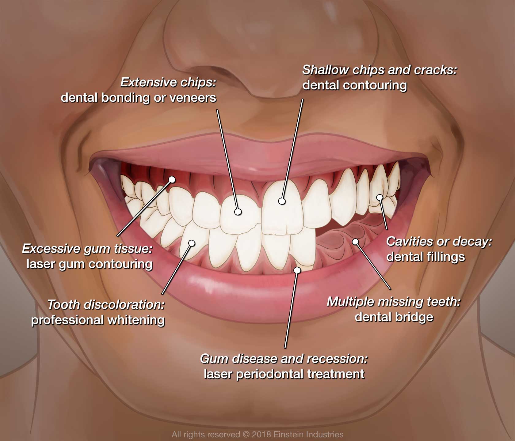 An illustration showing how dental treatments can improve the smile