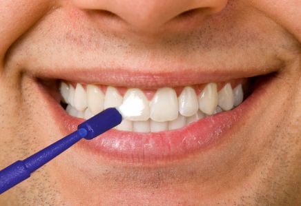 Man undergoing fluoride treatment