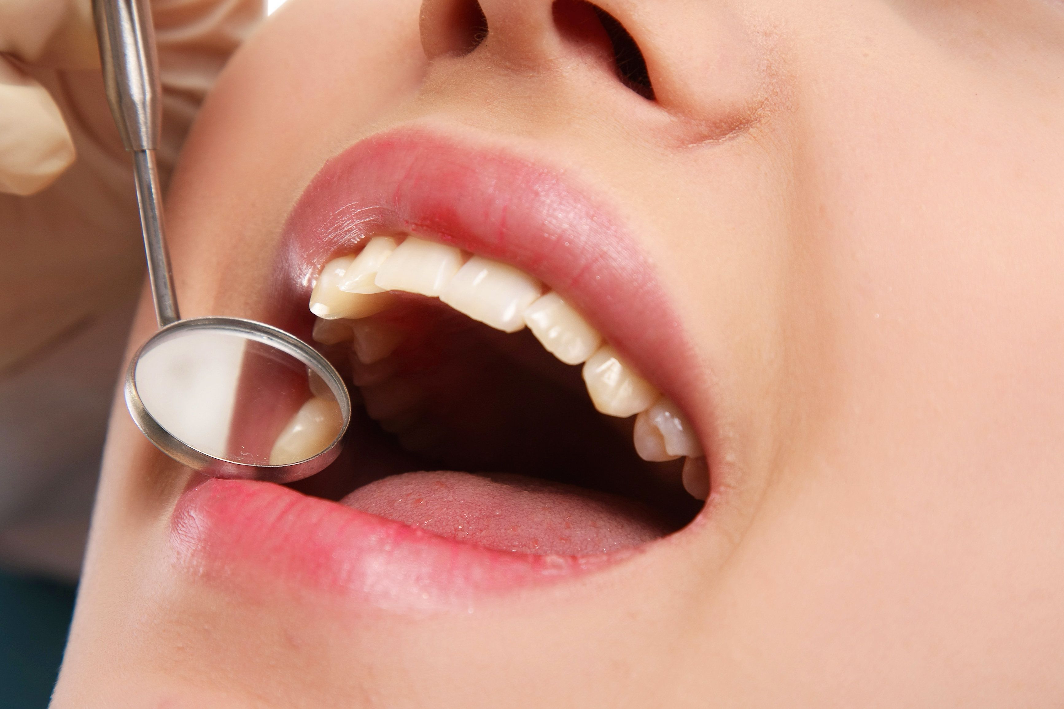 Close up of woman's mouth and dental instruments